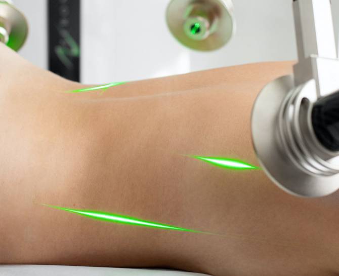 LASEROTERAPIA